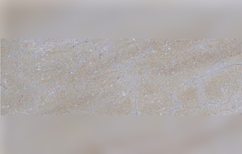 Abadeh Iraji Marble