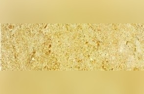 Asian Gold