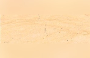 Jerusalem Golden Veins