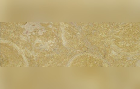 Amarelo Valverde Limestone