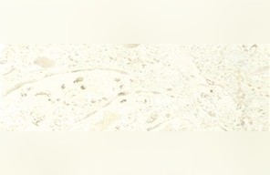 Fletto Limestone