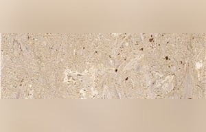 Giallo Dorato Limestone