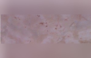 Global Pink Marble