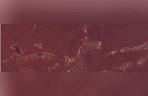 Kinnekulle Roedrosig Limestone