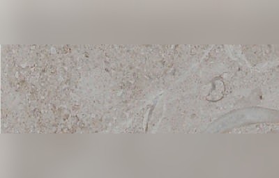 White Hearth Marble